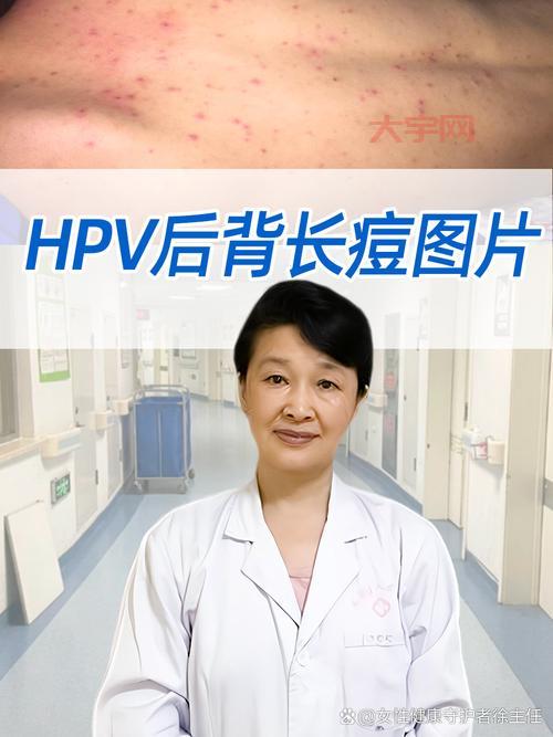 北京病例怎么感染的？传播链条清晰解读！
